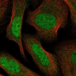 Protein phosphatase 1F Antibody, Novus Biologicals 0.1mL; Unlabeled:Antibodies,